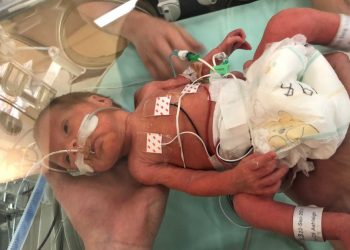 Give Premature Babies a chance to survive- Prof Eregie