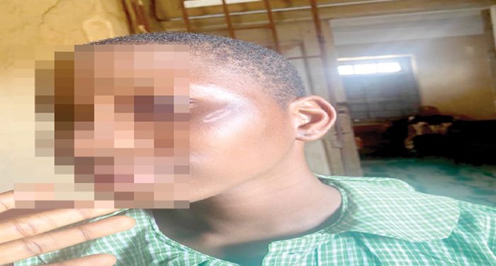 Guardians tackle government school, charge attack on 14-year-old girl