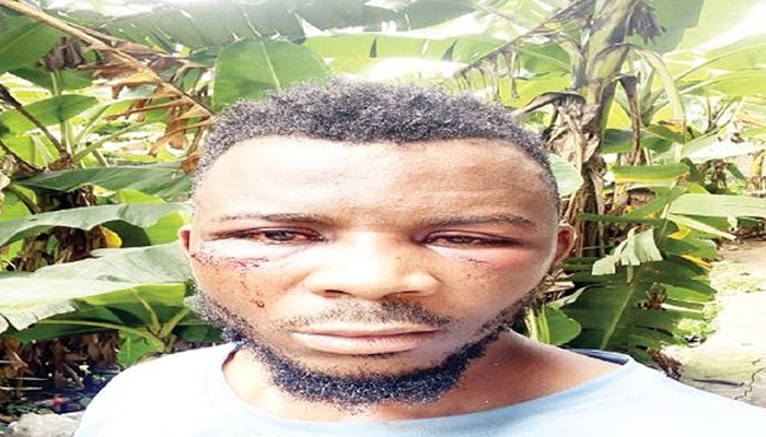 Man fighting police provocation abused in Ogun