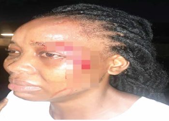 Sibling grabbed for attacking sister in Lagos