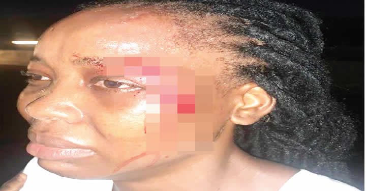 Sibling grabbed for attacking sister in Lagos