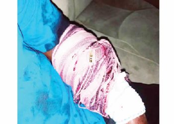 Residents lament as hoodlums terrorise Lagos community, stab man