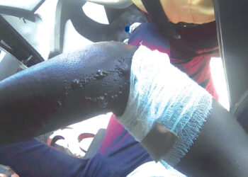 Lagos Driver Sets LASTMA Officer Ablaze, Flees Scene