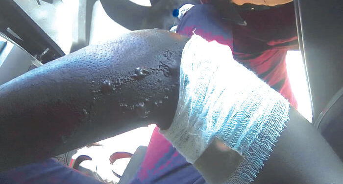 Lagos Driver Sets LASTMA Officer Ablaze, Flees Scene