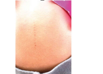 Parents Accuse Ogun School of Making Incisions on Children's Bodies