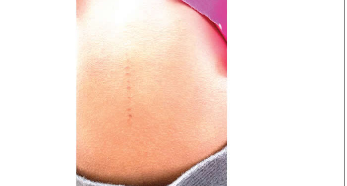 Parents Accuse Ogun School of Making Incisions on Children's Bodies