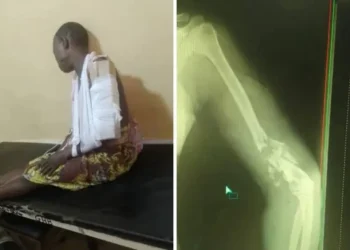 Immigration Officer Allegedly Shoots Woman in Badagry Community