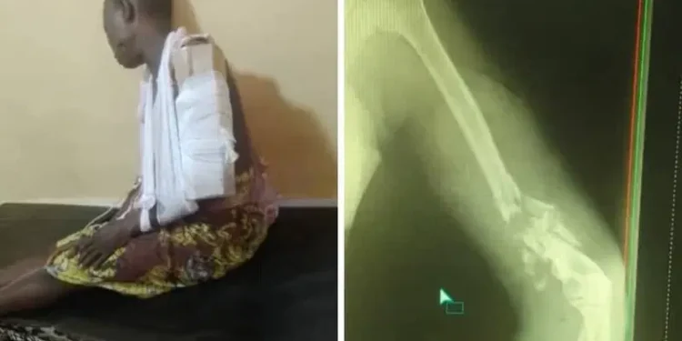 Immigration Officer Allegedly Shoots Woman in Badagry Community