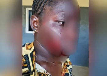 Wife’s Jealousy Turns Violent: Taraba Woman Attacks Teenager Over Husband’s Interest