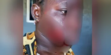 Wife’s Jealousy Turns Violent: Taraba Woman Attacks Teenager Over Husband’s Interest