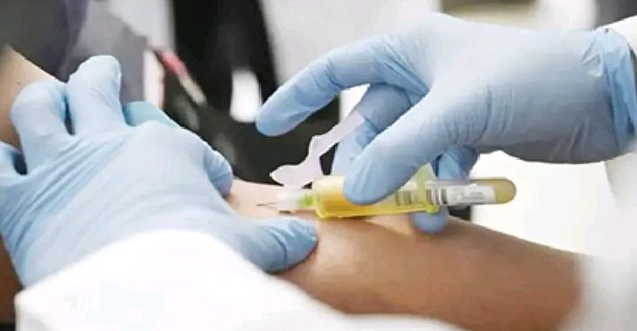 “Nigeria Secures Breakthrough Twice Yearly HIV Prevention Injection to Strengthen National Fight Against AIDS”