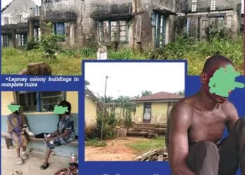 Neglected and Forgotten: The Plight of Uzuakoli Leprosy Colony Inmates