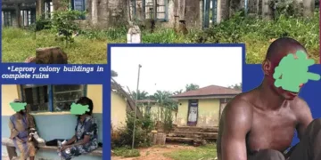 Neglected and Forgotten: The Plight of Uzuakoli Leprosy Colony Inmates