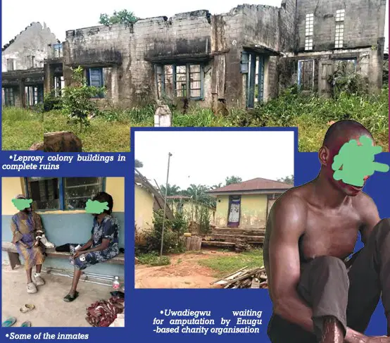 Neglected and Forgotten: The Plight of Uzuakoli Leprosy Colony Inmates