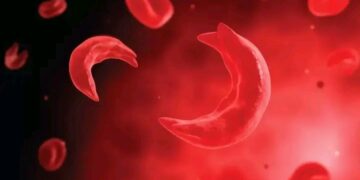 “Coalition Calls for Mandatory Genotype Testing Before Marriage to Reduce Sickle Cell Disease in Nigeria”