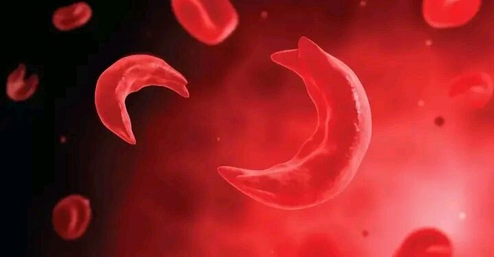 “Coalition Calls for Mandatory Genotype Testing Before Marriage to Reduce Sickle Cell Disease in Nigeria”