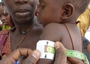 MSF Treats Over 87,000 Children for Malnutrition in Katsina in Eight Months, Warns of Persistent Nutrition Crisis.