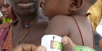 MSF Treats Over 87,000 Children for Malnutrition in Katsina in Eight Months, Warns of Persistent Nutrition Crisis.